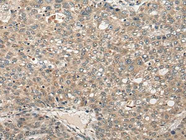 Anti-Human FUT4 Antibody