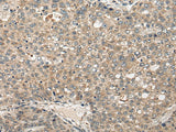 Anti-Human FUT4 Antibody - ABMIUM