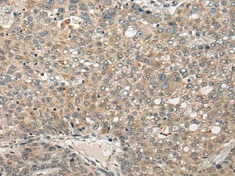 Anti-Human FUT4 Antibody - ABMIUM