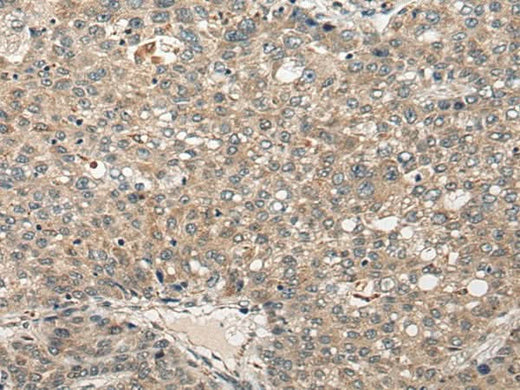 Anti-Human FUT4 Antibody - ABMIUM