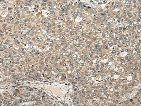 Anti-Human FUT4 Antibody - ABMIUM