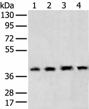 Western blot analysis of 231 cell Human testis tissue Hela and Hepg2 cell using TBP Polyclonal Antibody at dilution of 1:400