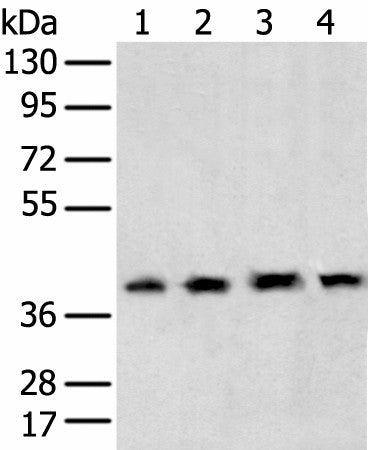 Western blot analysis of 231 cell Human testis tissue Hela and Hepg2 cell using TBP Polyclonal Antibody at dilution of 1:400