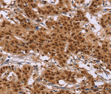 Anti-Human/Mouse/Rat CTNNBL1 Antibody - ABMIUM