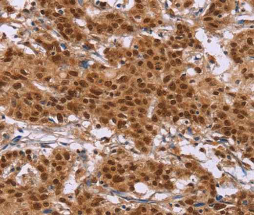 Anti-Human/Mouse/Rat CTNNBL1 Antibody
