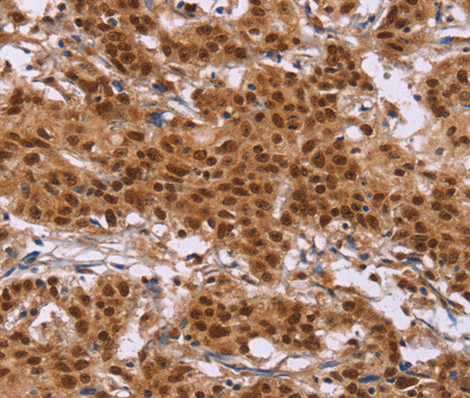 Anti-Human/Mouse/Rat CTNNBL1 Antibody - ABMIUM