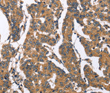 Anti-Human/Mouse BNIP2 Antibody - ABMIUM