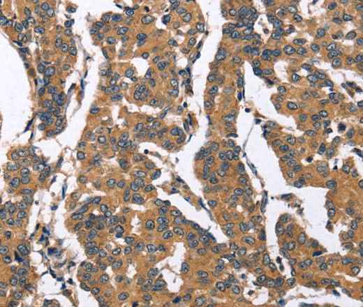 Anti-Human/Mouse BNIP2 Antibody