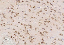 Anti-Human SerpinI1 Antibody [A1057] - ABMIUM