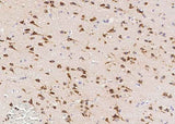Anti-Human SerpinI1 Antibody [A1057] - ABMIUM