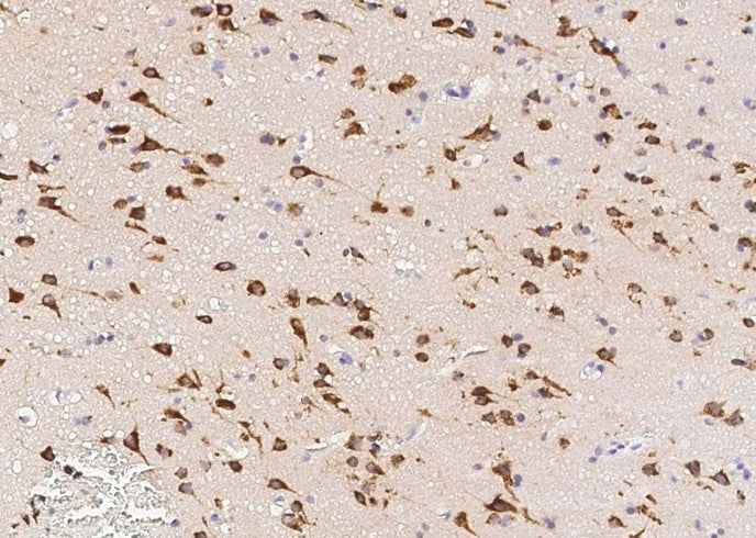 Anti-Human SerpinI1 Antibody [A1057] - ABMIUM