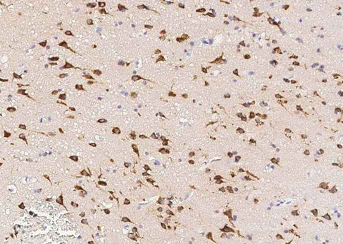 Anti-Human SerpinI1 Antibody [A1057] - ABMIUM
