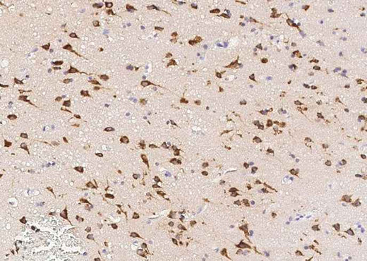 Anti-Human SerpinI1 Antibody [A1057] - ABMIUM