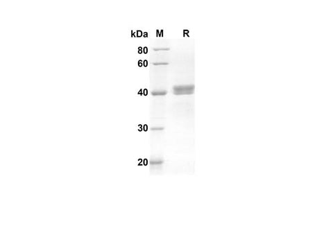 SDS-PAGE analysis of Human GDNF proteins, 2 μg/lane of Recombinant Human GDNF proteins was resolved with an SDS-PAGE under reducing conditions, showing bands at 36.2 kDa.