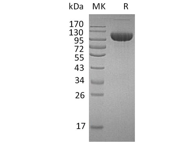 Recombinant Human FGFR3/CD333 Protein (Fc Tag) - ABMIUM