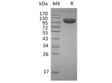 Recombinant Human FGFR3/CD333 Protein (Fc Tag) - ABMIUM