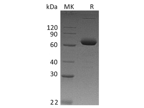 Recombinant Human IL-2RB/CD122 Protein (Fc Tag) - ABMIUM