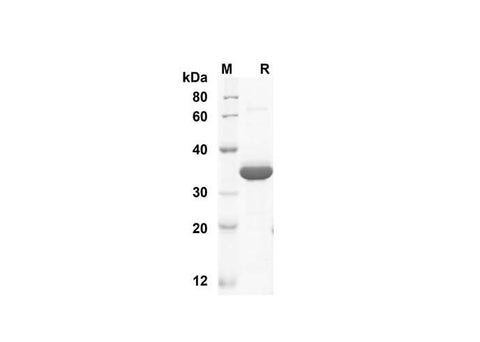 SDS-PAGE analysis of Human Fc proteins, 2 μg/lane of Recombinant Human Fc proteins was resolved with SDS-PAGE under reducing conditions, showing bands at 25 kDa.