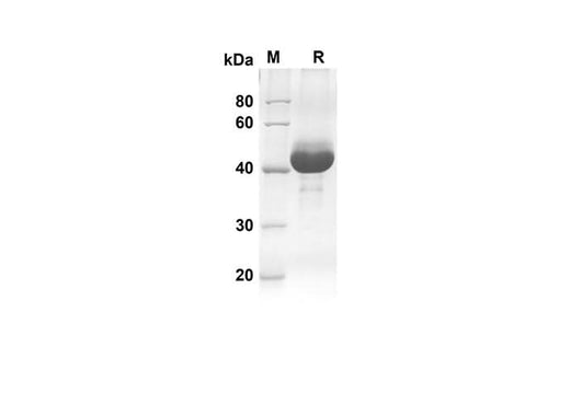 SDS-PAGE analysis of Human CDNF proteins, 2 μg/lane of Recombinant Human CDNF proteins was resolved with an SDS-PAGE under reducing conditions, showing bands at 45.4 kDa.