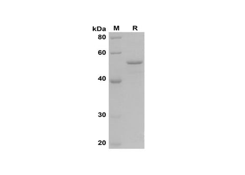 SDS-PAGE analysis of Mouse CD147 proteins, 2 μg/lane of Recombinant Mouse CD147 proteins was resolved with SDS-PAGE under reducing conditions, showing bands at 50 kDa.