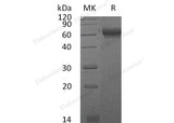 Recombinant Mouse CHL2/CHRDL2 Protein (His Tag) - ABMIUM