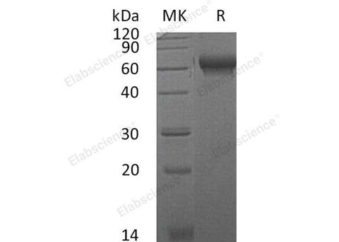 Recombinant Mouse CHL2/CHRDL2 Protein (His Tag) - ABMIUM
