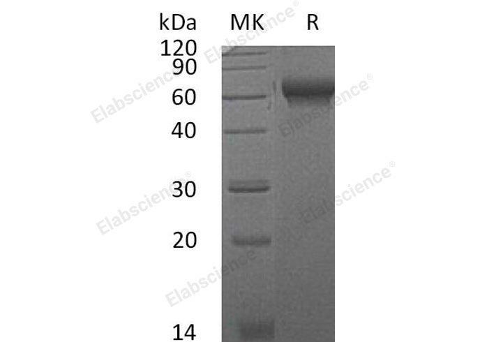 Recombinant Mouse CHL2/CHRDL2 Protein (His Tag) - ABMIUM