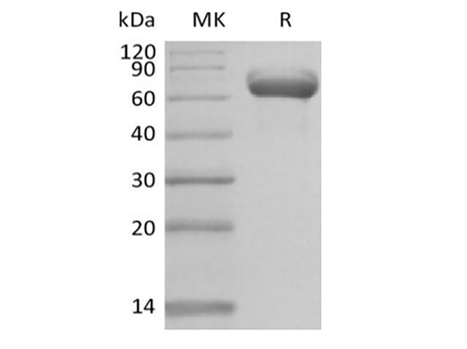 Recombinant Human Butyrophilin Subfamily 1 Member A1/BTN1A1 (C-Fc) - ABMIUM