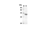 SDS-PAGE analysis of Human MLKL proteins, 2 μg/lane of Recombinant Human MLKL proteins was resolved with SDS-PAGE under reducing conditions, showing bands at 32.6 kDa.