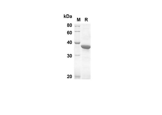 SDS-PAGE analysis of Human MLKL proteins, 2 μg/lane of Recombinant Human MLKL proteins was resolved with SDS-PAGE under reducing conditions, showing bands at 32.6 kDa.