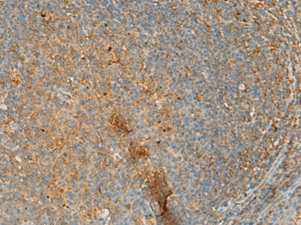 Immunohistochemistry of paraffin-embedded Human tonsil tissue using ERAL1 Polyclonal Antibody at dilution of 1:50(×200)