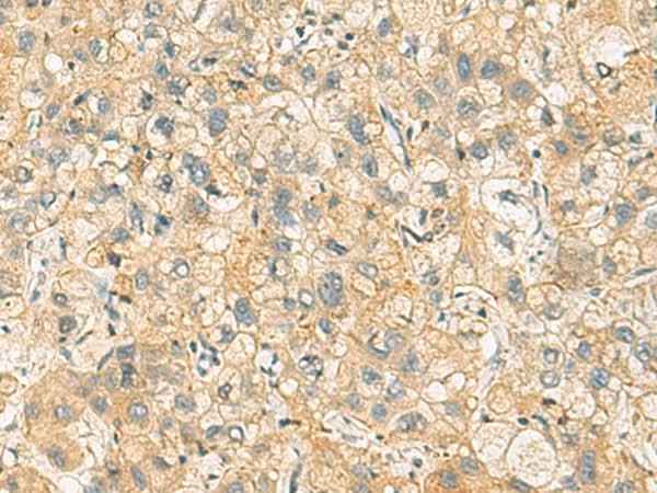 Anti-Human/Mouse/Rat NANP Antibody
