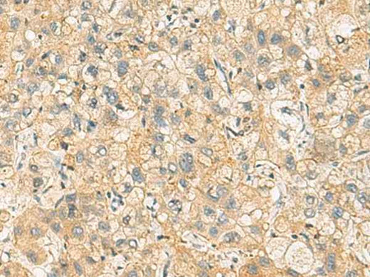 Anti-Human/Mouse/Rat NANP Antibody