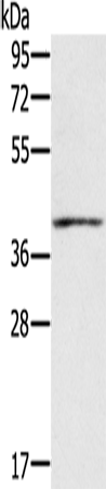 Anti-Human/Mouse IFNGR2 Antibody - ABMIUM