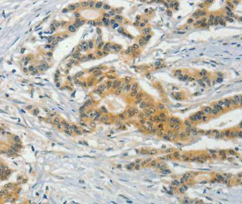 Anti-Human/Mouse ASB8 Antibody
