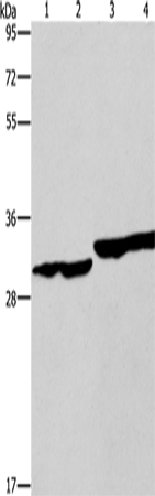 Anti-Human/Mouse/Rat DECR1 Antibody - ABMIUM