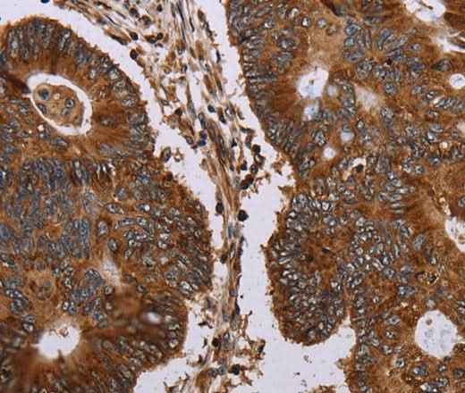 Anti-Human MAGEC2 Antibody