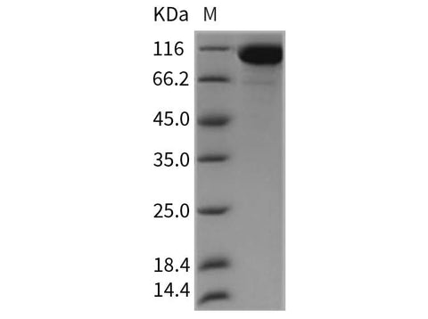 Recombinant Rat Semaphorin 4D/SEMA4D/ Protein (His Tag) - ABMIUM