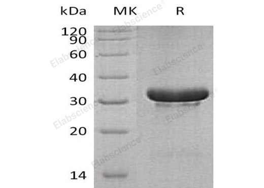 Recombinant Human TRIM5/RNF88 Protein (His Tag) - ABMIUM