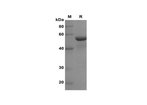 SDS-PAGE analysis of Human ALDH1A1 proteins, 2 μg/lane of Recombinant Human ALDH1A1 proteins was resolved with SDS-PAGE under reducing conditions, showing bands at 58 kDa.