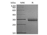Recombinant Human Retbindin/RTBDN Protein (His Tag) - ABMIUM