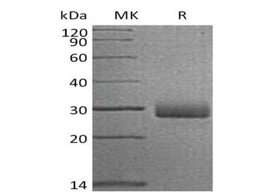 Recombinant Human Retbindin/RTBDN Protein (His Tag) - ABMIUM