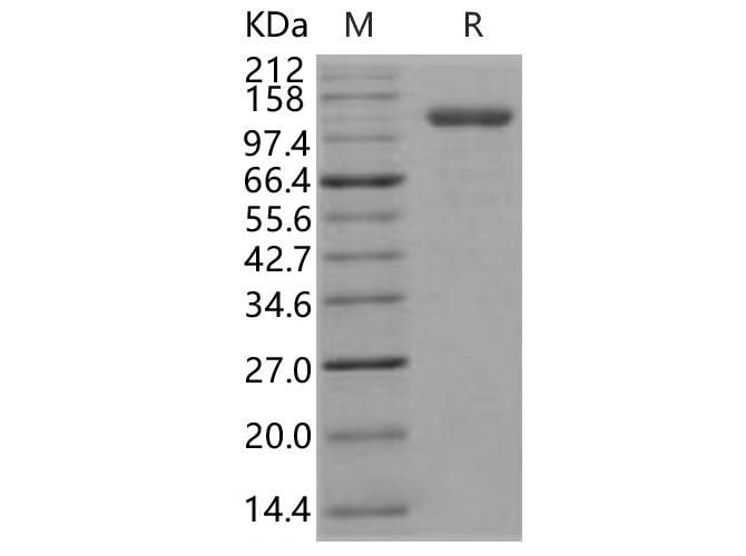 Recombinant Human Endoglin/CD105 Protein (Fc Tag) - ABMIUM