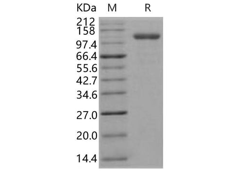 Recombinant Human Endoglin/CD105 Protein (Fc Tag) - ABMIUM