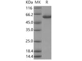 Recombinant Human Galactolipase/PLRP2 Protein (His Tag) - ABMIUM
