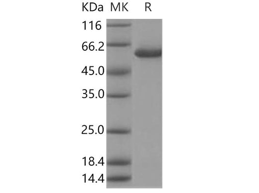 Recombinant Human Galactolipase/PLRP2 Protein (His Tag) - ABMIUM