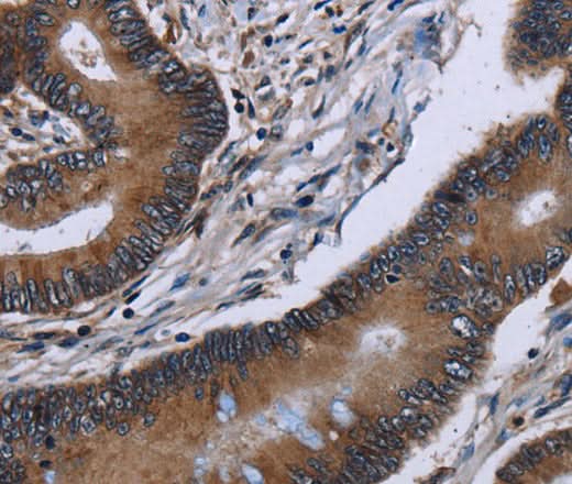 Anti-Human ITGAE Antibody - ABMIUM