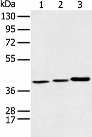 Western blot analysis of Human fetal liver tissue Hela cell and Human fetal brain tissue using MORF4L1 Polyclonal Antibody at dilution of 1:350