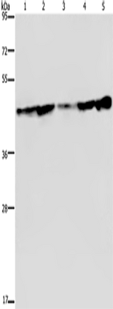 Anti-Human CERS4 Antibody - ABMIUM