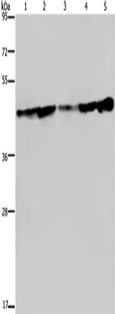 Anti-Human CERS4 Antibody - ABMIUM